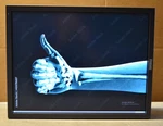 Grade B Totoku/jvc CCL356I2 21.3" Monitor Radiology 2048X1536 Dvi Dport No Stand Used. Price: $59.99.